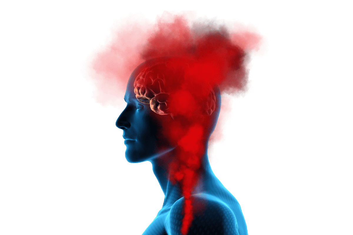 Exposure to hate can result in post-traumatic stress disorder and a host of other problems, says Dr. Mario F. Mendez, author of “A Brain Mechanism for Hate.” Canva image created by Jan Snyder.